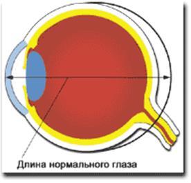 Изображение позади сетчатки. Устройство глаза. Переднезадний размер глаза. Переднезадний размер глазного яблока. Гиперметропия передне-задний размер глаза.